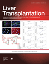 liver_transplantation.gif